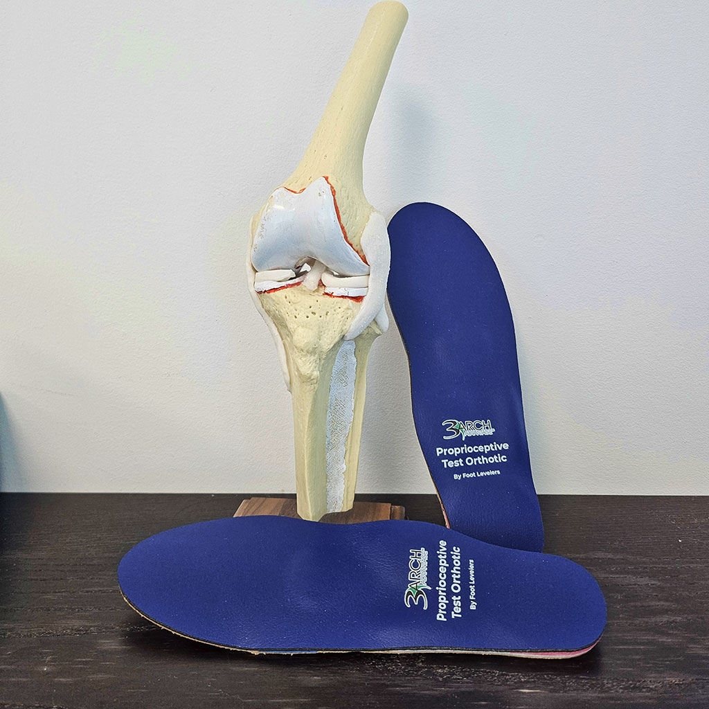 Knee-Pain